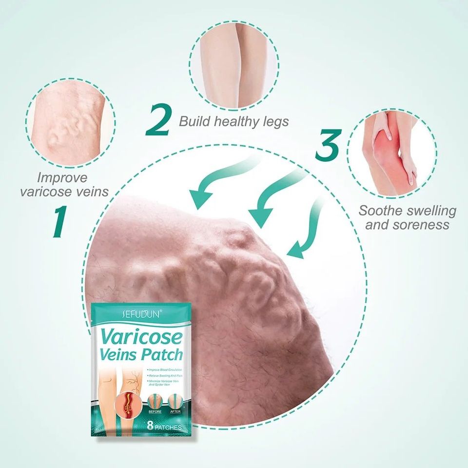 Parche para varices Patch (8 und)