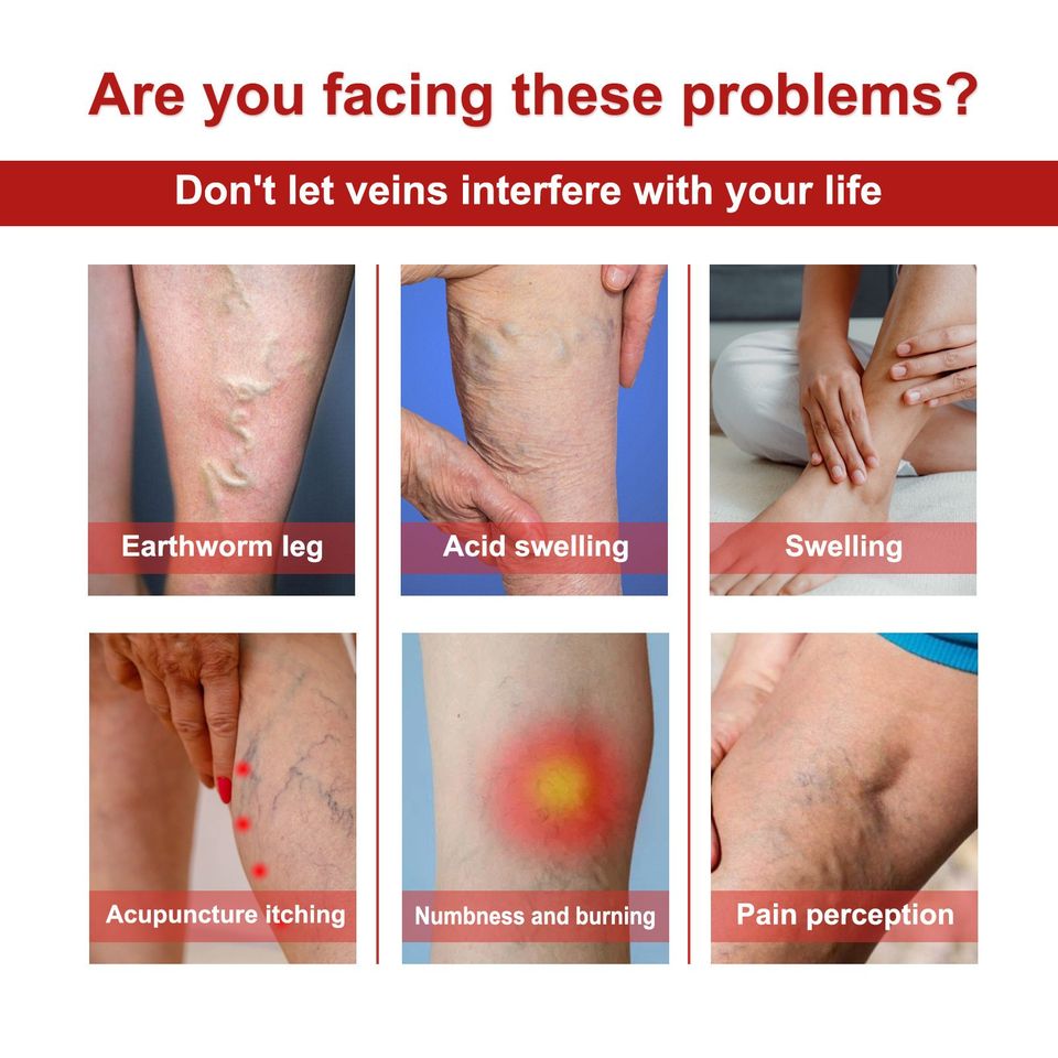 Parche para Varices (6und)